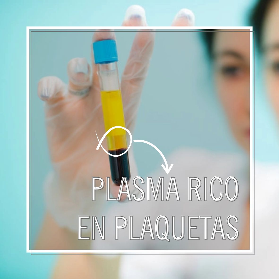 Plasma rico en Plaquetas – Cutaneo Dermatología
